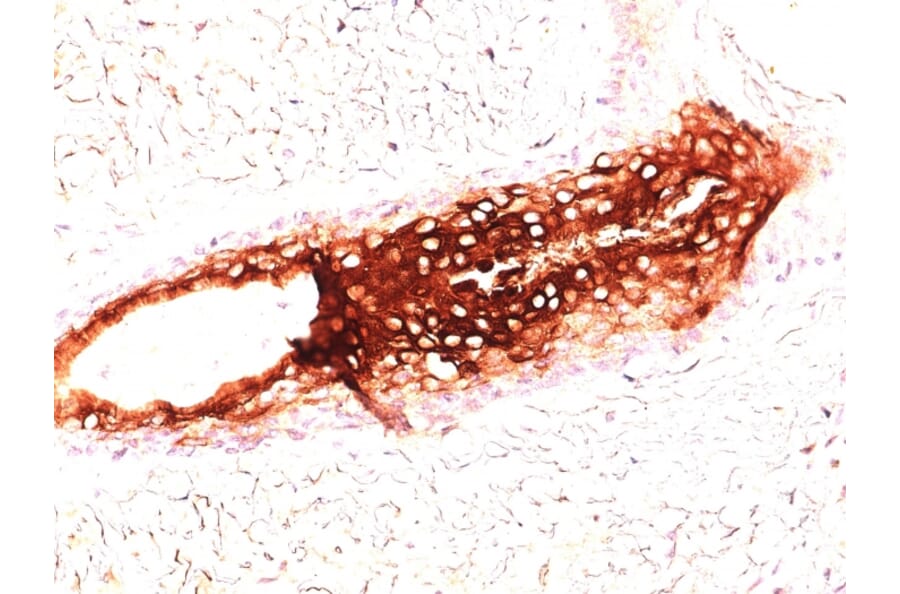 Immunohistochemistry - Anti-Cytokeratin 17 Antibody [SPM560] - BSA and Azide free (A252370) - Antibodies.com
