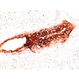 Immunohistochemistry - Anti-Cytokeratin 17 Antibody [SPM560] - BSA and Azide free (A252370) - Antibodies.com