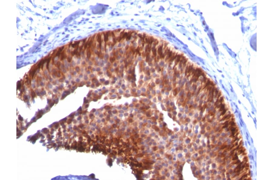 Immunohistochemistry - Anti-Cytokeratin 17 Antibody [KRT17/778] - BSA and Azide free (A252370) - Antibodies.com