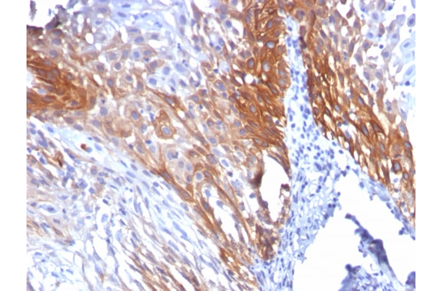 Immunohistochemistry - Anti-Cytokeratin 17 Antibody [KRT17/778] - BSA and Azide free (A252371) - Antibodies.com