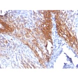 Immunohistochemistry - Anti-Cytokeratin 17 Antibody [KRT17/778] - BSA and Azide free (A252371) - Antibodies.com