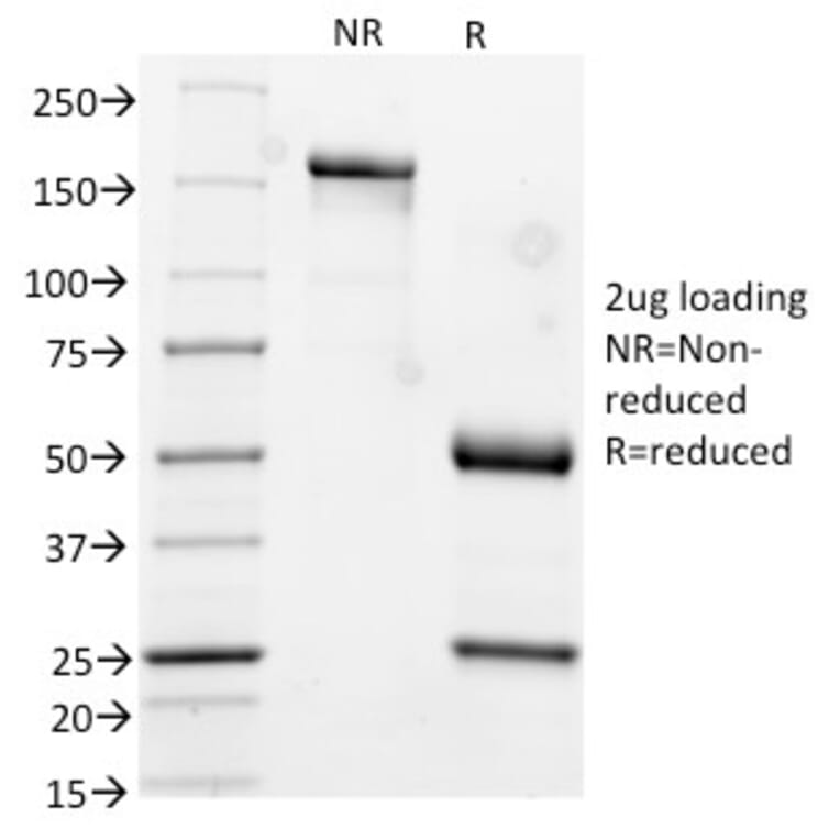SDS-PAGE - Anti-Cytokeratin 17 Antibody [KRT17/778] - BSA and Azide free (A252371) - Antibodies.com