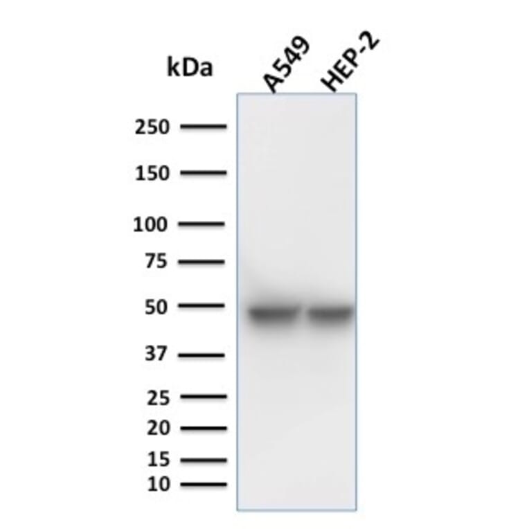 Western Blot - Anti-Cytokeratin 18 Antibody [KRT18/1190] - BSA and Azide free (A252372) - Antibodies.com