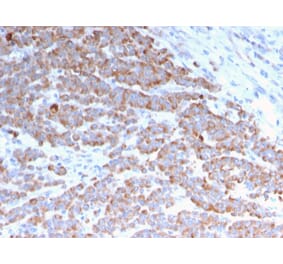 Immunohistochemistry - Anti-Cytokeratin 18 Antibody [rKRT18/1190] - BSA and Azide free (A252373) - Antibodies.com