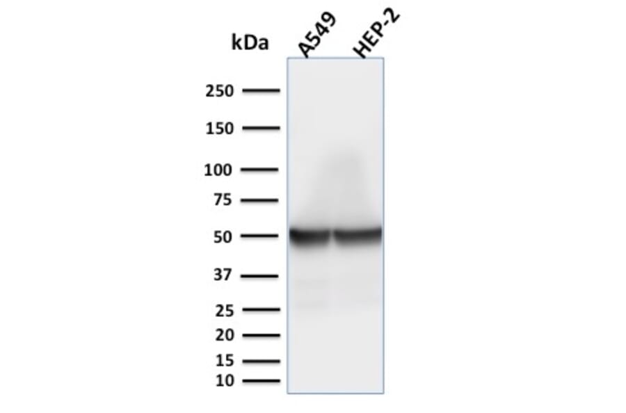 Western Blot - Anti-Cytokeratin 18 Antibody [rKRT18/1190] - BSA and Azide free (A252373) - Antibodies.com