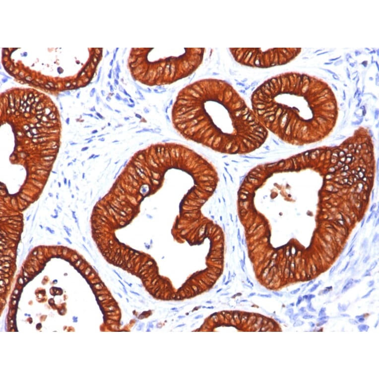 Immunohistochemistry - Anti-Cytokeratin 18 Antibody [DC10] - BSA and Azide free (A252373) - Antibodies.com