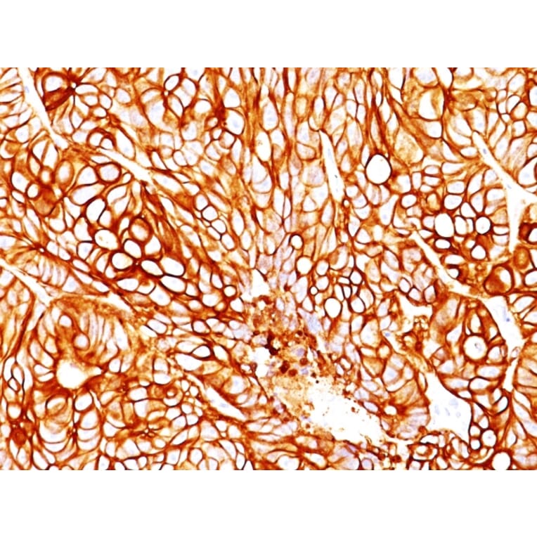 Immunohistochemistry - Anti-Cytokeratin 18 Antibody [DA7] - BSA and Azide free (A252376) - Antibodies.com