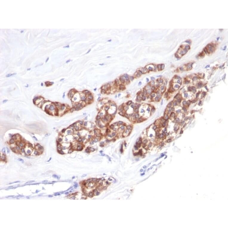 Immunohistochemistry - Anti-Cytokeratin 18 Antibody [SPM510] - BSA and Azide free (A252377) - Antibodies.com