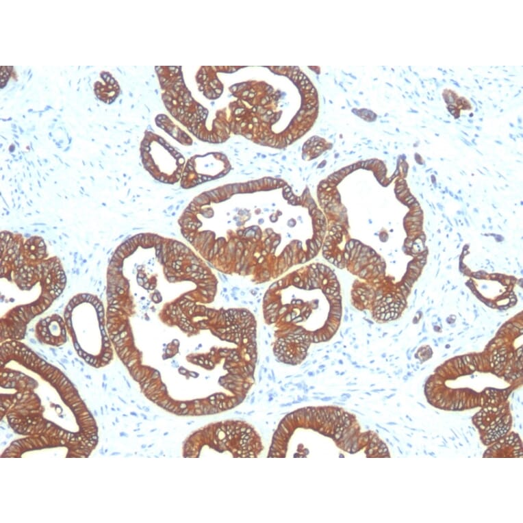 Immunohistochemistry - Anti-Cytokeratin 18 Antibody [DE-K18] - BSA and Azide free (A252378) - Antibodies.com