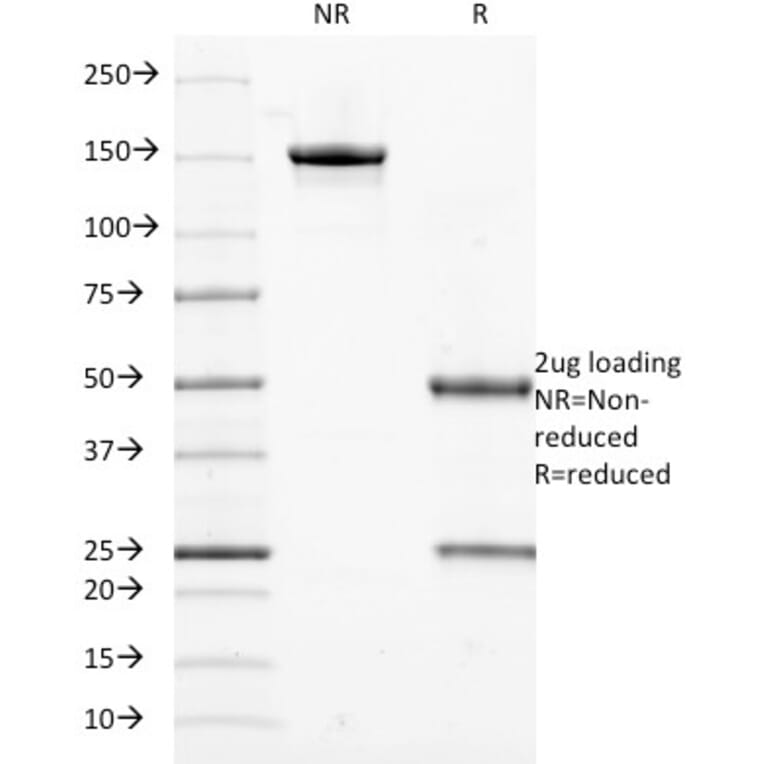 SDS-PAGE - Anti-Cytokeratin 18 Antibody [DE-K18] - BSA and Azide free (A252378) - Antibodies.com