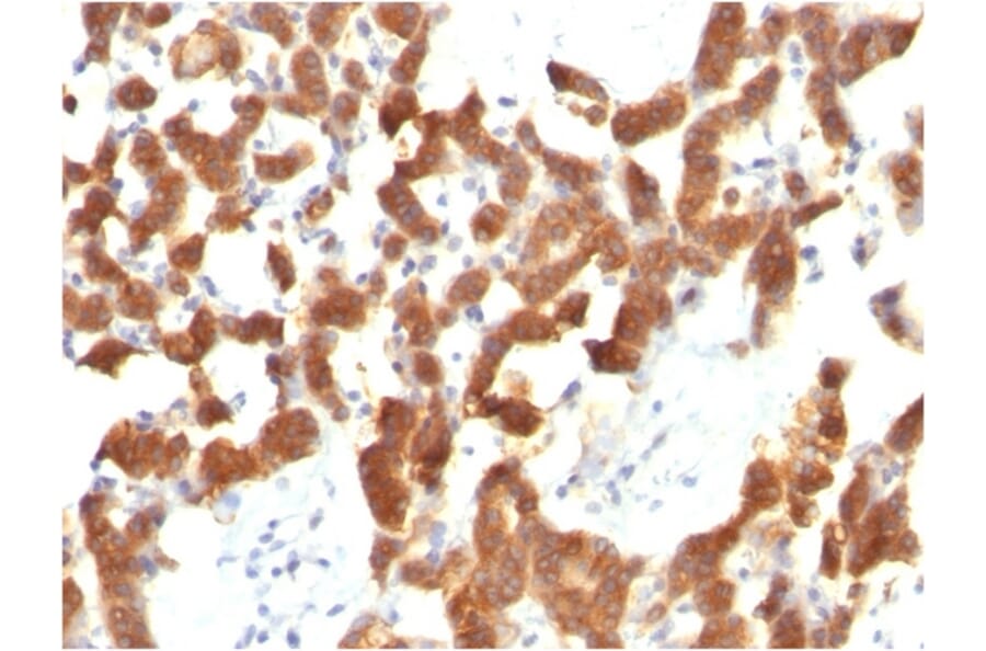 Immunohistochemistry - Anti-Cytokeratin 18 Antibody [KRT18/834] - BSA and Azide free (A252379) - Antibodies.com