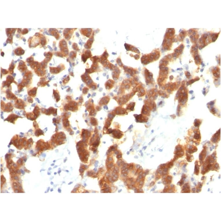 Immunohistochemistry - Anti-Cytokeratin 18 Antibody [KRT18/834] - BSA and Azide free (A252379) - Antibodies.com