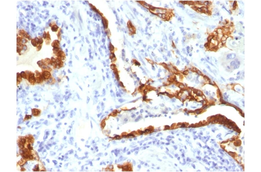 Immunohistochemistry - Anti-Cytokeratin 18 Antibody [KRT18/834] - BSA and Azide free (A252379) - Antibodies.com