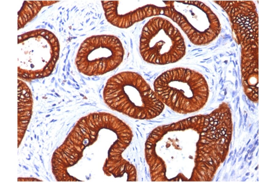 Immunohistochemistry - Anti-Cytokeratin 18 Antibody [KRT18/834] - BSA and Azide free (A252379) - Antibodies.com