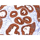 Immunohistochemistry - Anti-Cytokeratin 18 Antibody [KRT18/834] - BSA and Azide free (A252379) - Antibodies.com