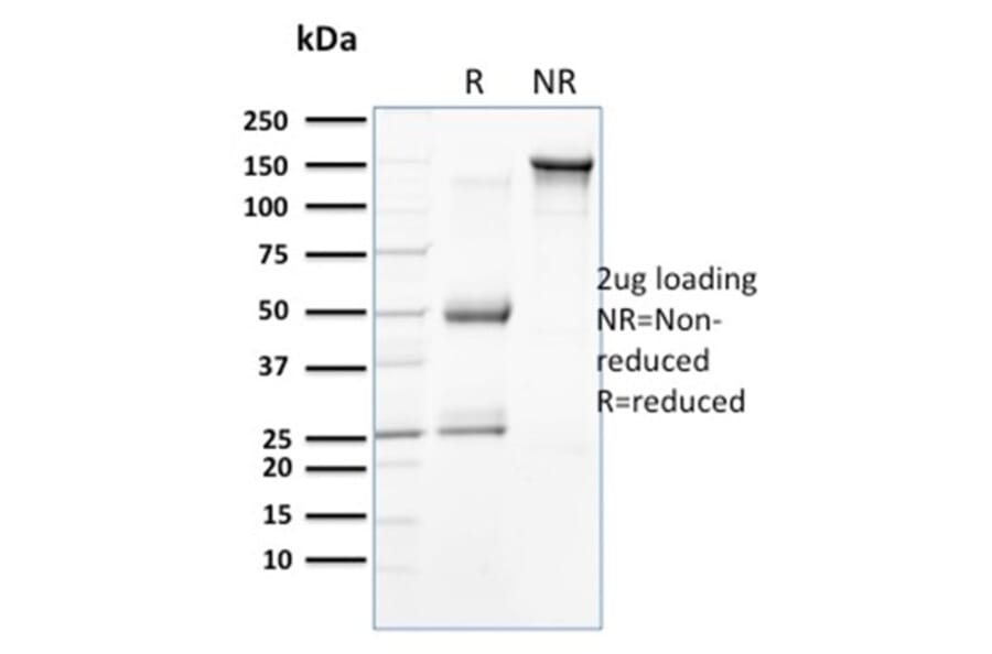 SDS-PAGE - Anti-Cytokeratin 18 Antibody [KRT18/834] - BSA and Azide free (A252379) - Antibodies.com