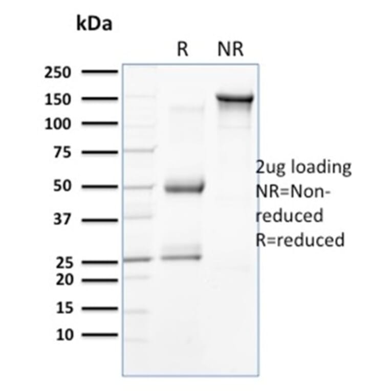 SDS-PAGE - Anti-Cytokeratin 18 Antibody [KRT18/834] - BSA and Azide free (A252379) - Antibodies.com