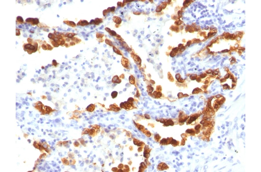 Immunohistochemistry - Anti-Cytokeratin 18 Antibody [KRT18/835] - BSA and Azide free (A252380) - Antibodies.com