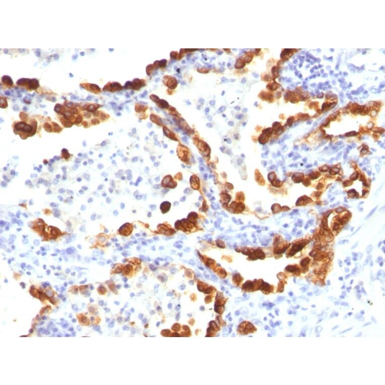 Immunohistochemistry - Anti-Cytokeratin 18 Antibody [KRT18/835] - BSA and Azide free (A252380) - Antibodies.com