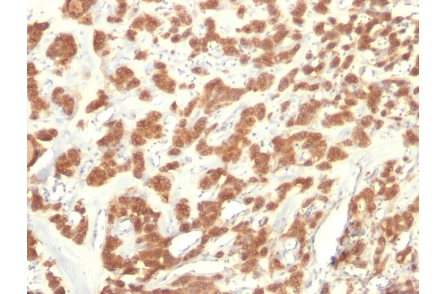 Immunohistochemistry - Anti-Cytokeratin 18 Antibody [KRT18/835] - BSA and Azide free (A252380) - Antibodies.com