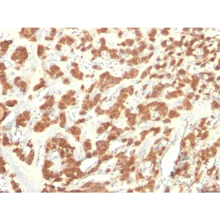 Immunohistochemistry - Anti-Cytokeratin 18 Antibody [KRT18/835] - BSA and Azide free (A252380) - Antibodies.com