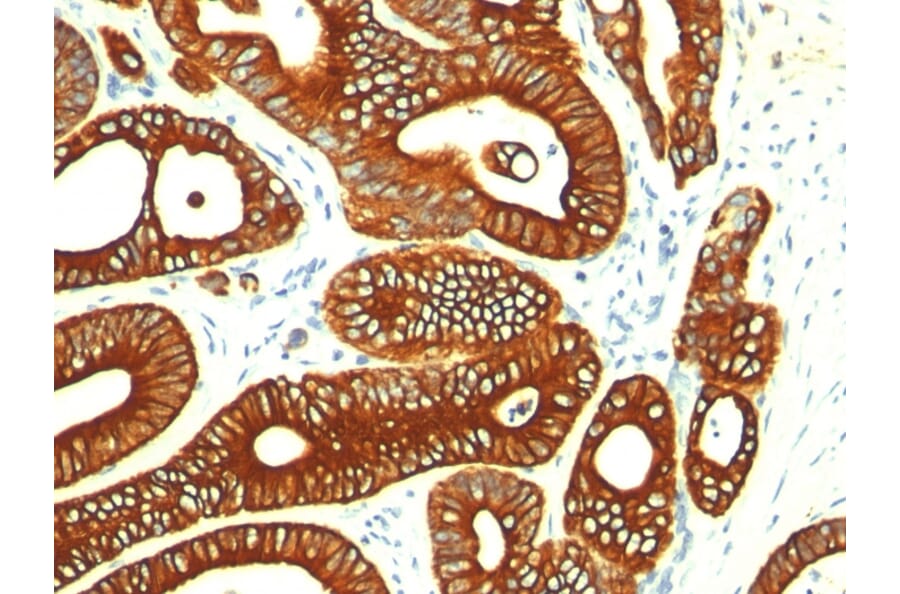 Immunohistochemistry - Anti-Cytokeratin 18 Antibody [KRT18/835] - BSA and Azide free (A252380) - Antibodies.com