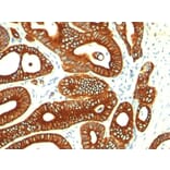 Immunohistochemistry - Anti-Cytokeratin 18 Antibody [KRT18/835] - BSA and Azide free (A252380) - Antibodies.com