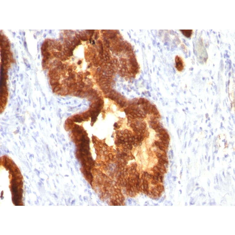 Immunohistochemistry - Anti-Cytokeratin 18 Antibody [KRT18/835] - BSA and Azide free (A252380) - Antibodies.com