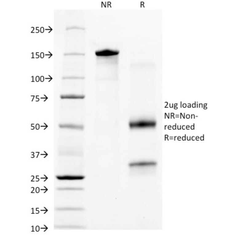 SDS-PAGE - Anti-Cytokeratin 18 Antibody [KRT18/836] - BSA and Azide free (A252381) - Antibodies.com