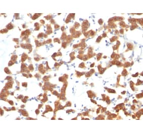 Immunohistochemistry - Anti-Cytokeratin 18 Antibody [C-04] - BSA and Azide free (A252382) - Antibodies.com