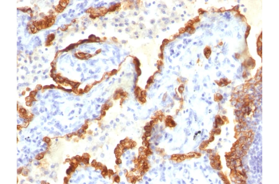 Immunohistochemistry - Anti-Cytokeratin 18 Antibody [Cocktail KRT18] - BSA and Azide free (A252383) - Antibodies.com