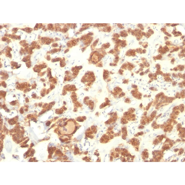 Immunohistochemistry - Anti-Cytokeratin 18 Antibody [Cocktail KRT18] - BSA and Azide free (A252383) - Antibodies.com