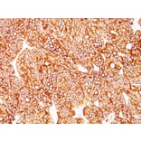 Immunohistochemistry - Anti-Cytokeratin 18 Antibody [Cocktail KRT18] - BSA and Azide free (A252383) - Antibodies.com