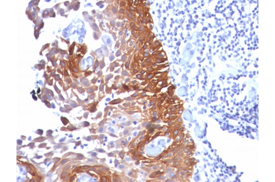 Immunohistochemistry - Anti-Cytokeratin 18 Antibody [Cocktail KRT18] - BSA and Azide free (A252383) - Antibodies.com