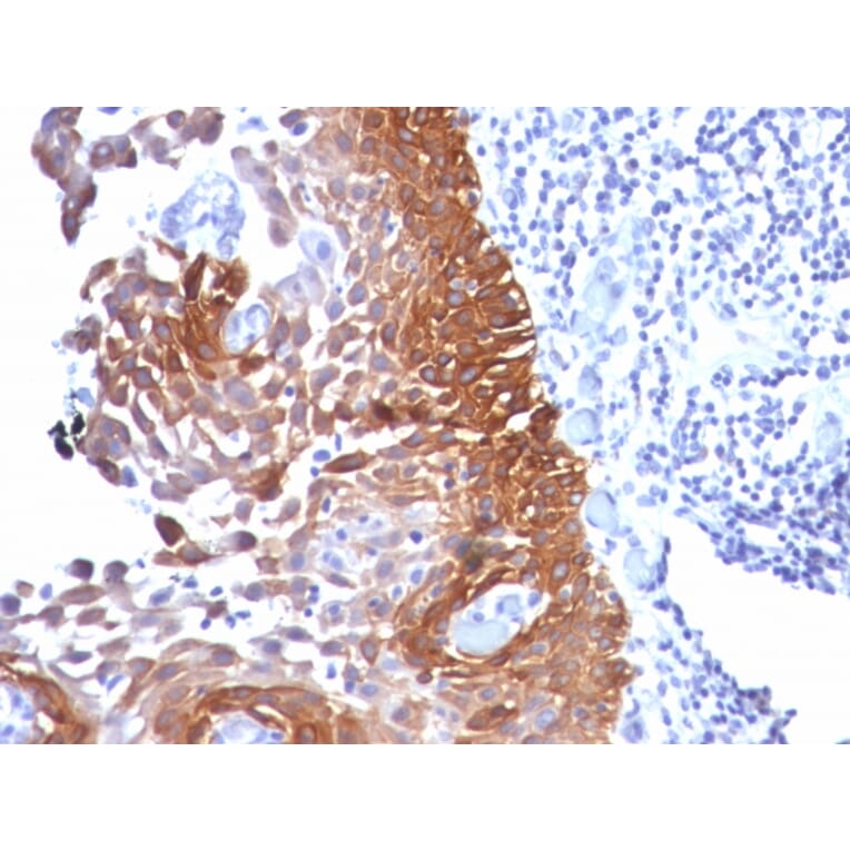 Immunohistochemistry - Anti-Cytokeratin 18 Antibody [Cocktail KRT18] - BSA and Azide free (A252383) - Antibodies.com