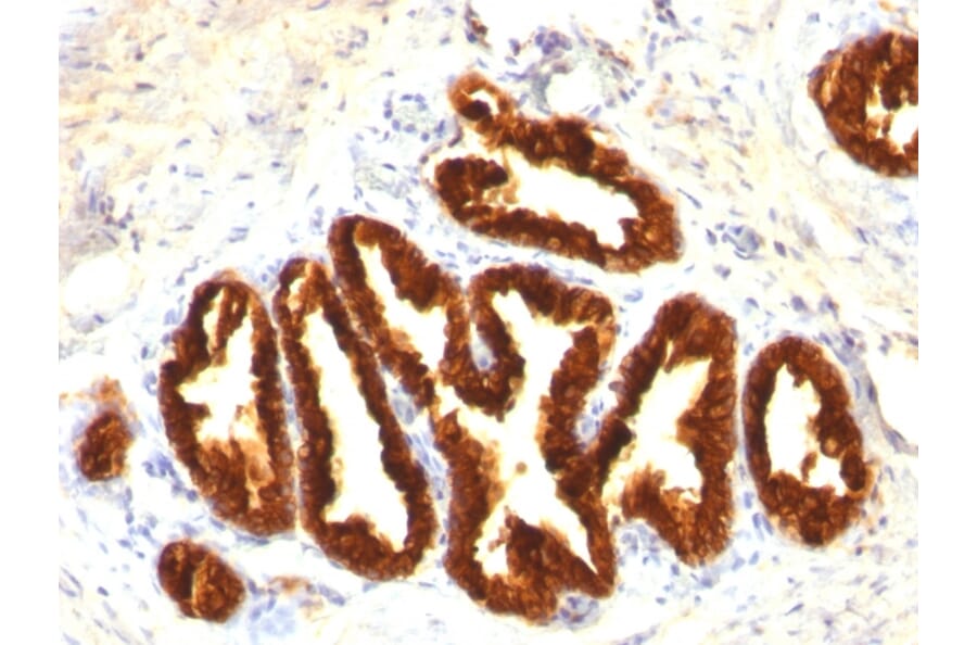 Immunohistochemistry - Anti-Cytokeratin 18 Antibody [Cocktail KRT18] - BSA and Azide free (A252383) - Antibodies.com