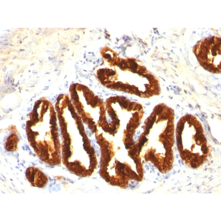 Immunohistochemistry - Anti-Cytokeratin 18 Antibody [Cocktail KRT18] - BSA and Azide free (A252383) - Antibodies.com