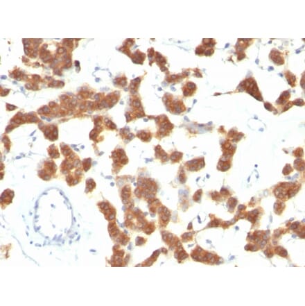 Immunohistochemistry - Anti-Cytokeratin 18 Antibody [B23.1] - BSA and Azide free (A252383) - Antibodies.com