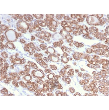 Immunohistochemistry - Anti-Cytokeratin 18 Antibody [KRT18/2808R] - BSA and Azide free (A252385) - Antibodies.com