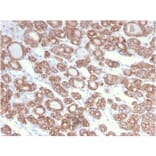 Immunohistochemistry - Anti-Cytokeratin 18 Antibody [KRT18/2808R] - BSA and Azide free (A252385) - Antibodies.com