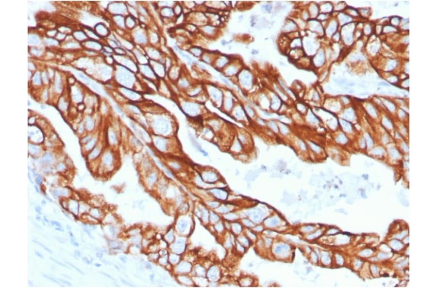 Immunohistochemistry - Anti-Cytokeratin 18 Antibody [KRT18/2808R] - BSA and Azide free (A252385) - Antibodies.com