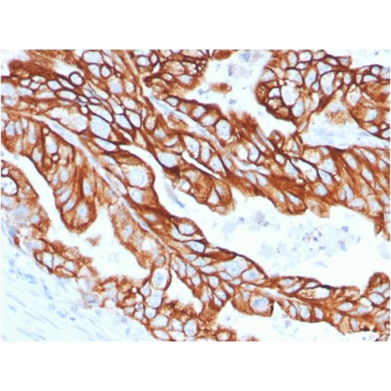 Immunohistochemistry - Anti-Cytokeratin 18 Antibody [KRT18/2808R] - BSA and Azide free (A252385) - Antibodies.com