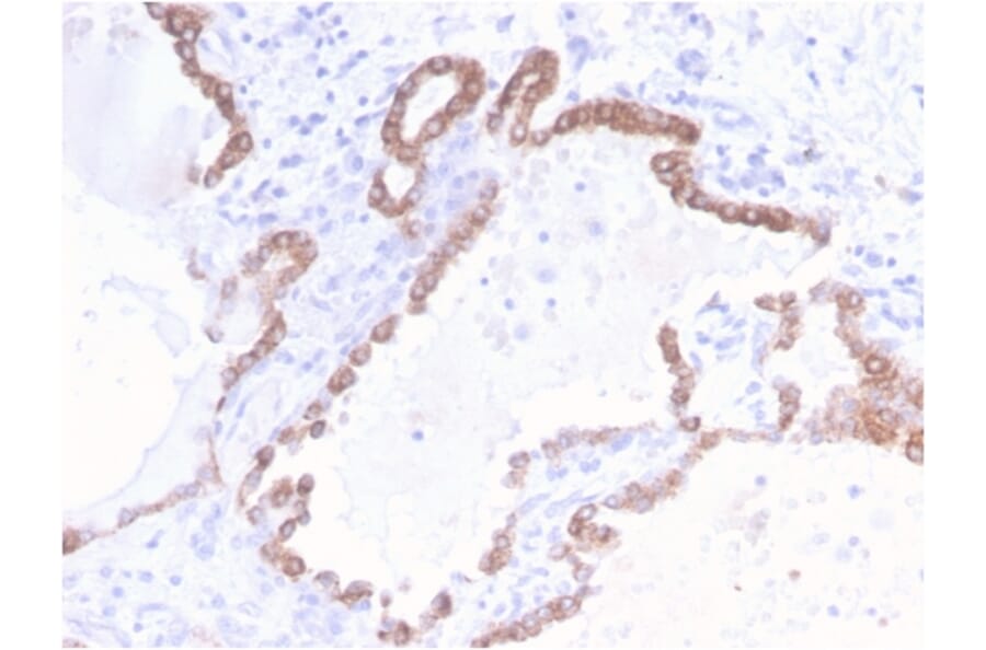 Immunohistochemistry - Anti-Cytokeratin 18 Antibody [KRT18/2808R] - BSA and Azide free (A252385) - Antibodies.com