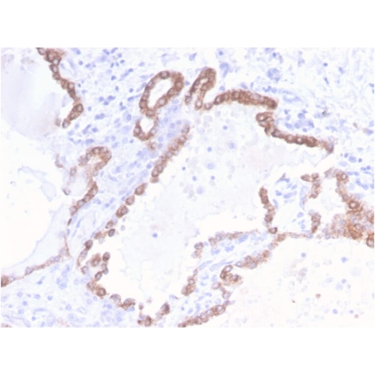 Immunohistochemistry - Anti-Cytokeratin 18 Antibody [KRT18/2808R] - BSA and Azide free (A252385) - Antibodies.com