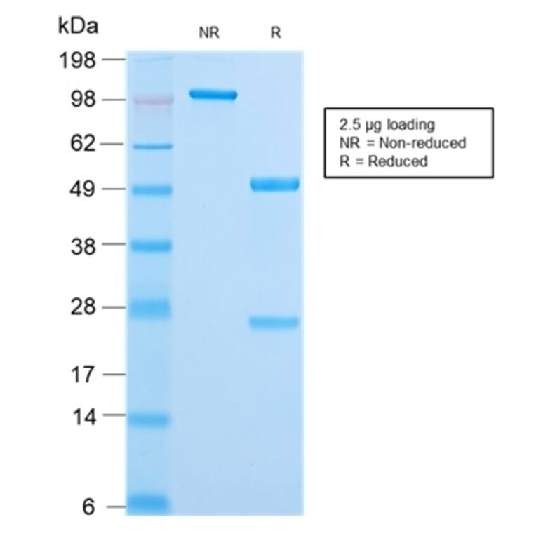 SDS-PAGE - Anti-Cytokeratin 18 Antibody [KRT18/2808R] - BSA and Azide free (A252385) - Antibodies.com