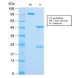 SDS-PAGE - Anti-Cytokeratin 18 Antibody [KRT18/2808R] - BSA and Azide free (A252385) - Antibodies.com