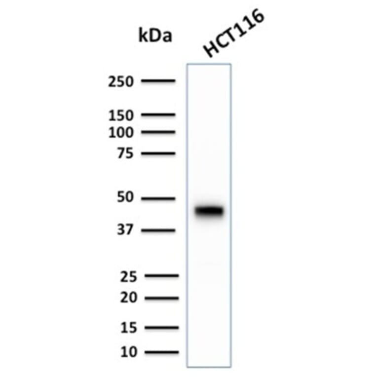 Western Blot - Anti-Cytokeratin 18 Antibody [KRT18/2808R] - BSA and Azide free (A252385) - Antibodies.com