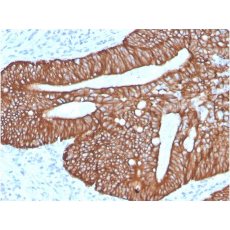 Immunohistochemistry - Anti-Cytokeratin 18 Antibody [KRT18/2819R] - BSA and Azide free (A252386) - Antibodies.com