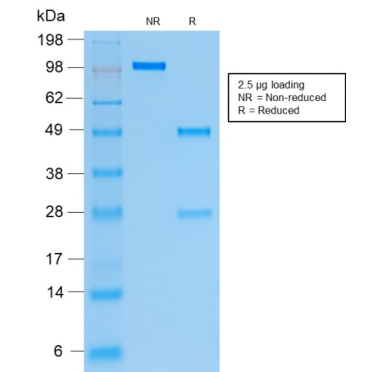 SDS-PAGE - Anti-Cytokeratin 19 Antibody [rKRT19/799] - BSA and Azide free (A252387) - Antibodies.com
