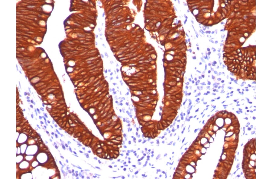 Immunohistochemistry - Anti-Cytokeratin 19 Antibody [A53-B/A2.26] - BSA and Azide free (A252388) - Antibodies.com